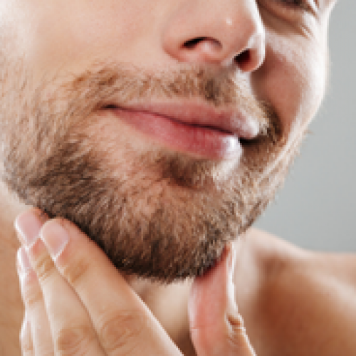 Beard Transplant