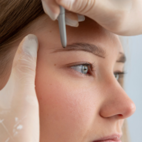 Eyebrow Transplant