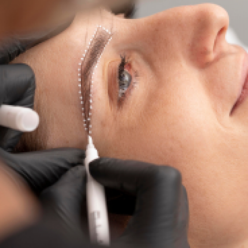 Eyebrow transplantation is usually performed for the following reasons
