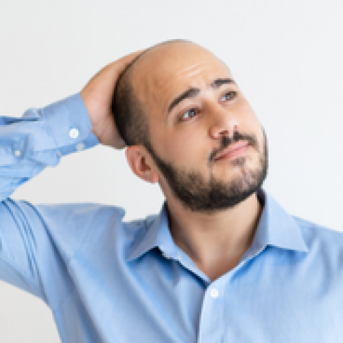 How Lifestyle Choices Affect Hair Loss and Hair Growth