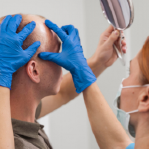How is FUE Hair Transplantation Performed?