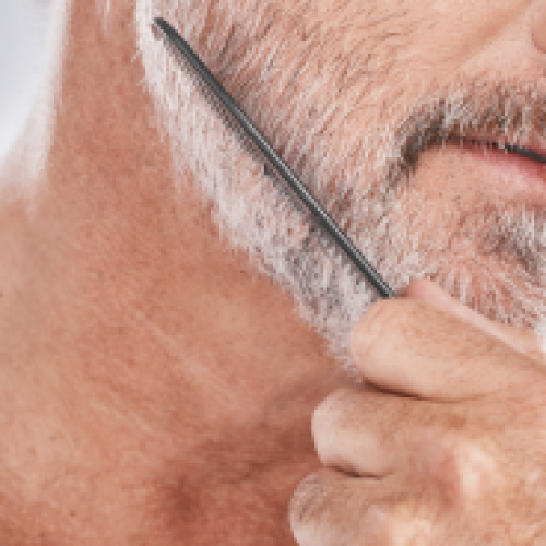 Is Beard Transplant Permanent?