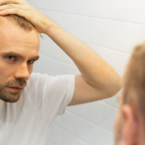 What to Expect on the Day of Your Hair Transplant Procedure
