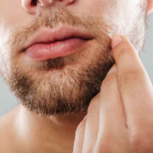Who is Suitable for Beard Transplantation?